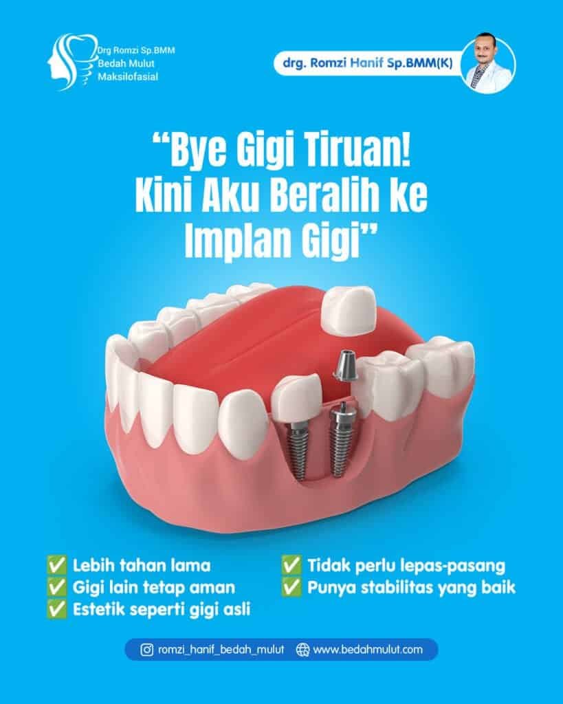 implan gigi
